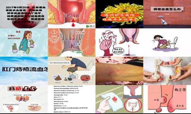 汕头坐月子期间痔疮流血怎么回事